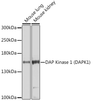 DAP Kinase 1 (DAPK1) Rabbit Polyclonal Antibody