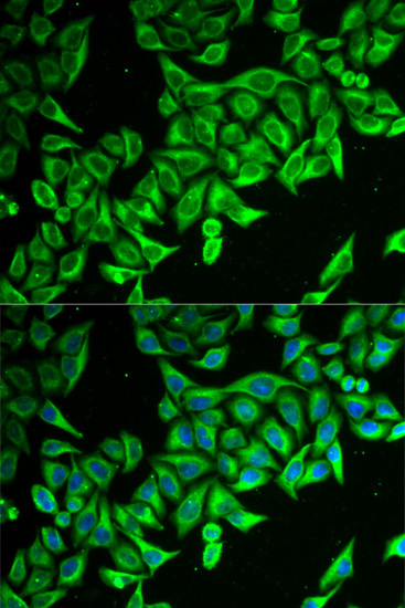 DAP Rabbit Polyclonal Antibody - Image 3
