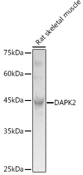 DAPK2 Rabbit Polyclonal Antibody