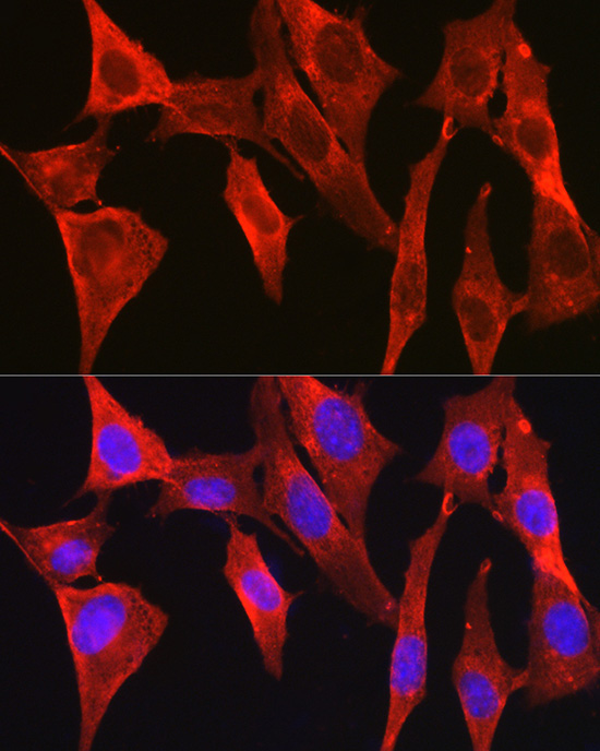 DAPK2 Rabbit Polyclonal Antibody - Image 2