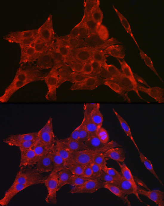 DAPK2 Rabbit Polyclonal Antibody - Image 3