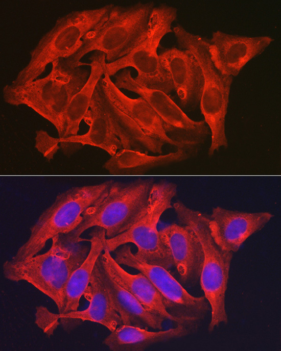 DAPK2 Rabbit Polyclonal Antibody - Image 4