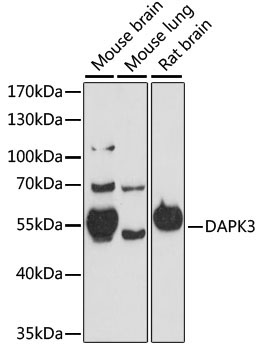 DAPK3 Rabbit Polyclonal Antibody