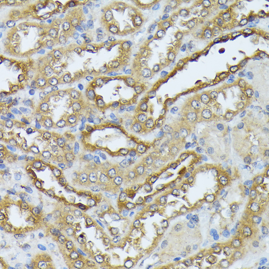 DAPK3 Rabbit Polyclonal Antibody - Image 2