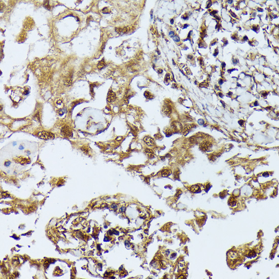 DAPK3 Rabbit Polyclonal Antibody - Image 3