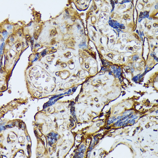 DAPK3 Rabbit Polyclonal Antibody - Image 4