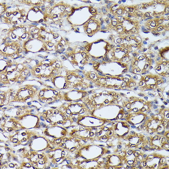 DAPK3 Rabbit Polyclonal Antibody - Image 5