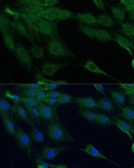DAPK3 Rabbit Polyclonal Antibody - Image 6