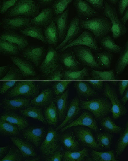 DAPK3 Rabbit Polyclonal Antibody - Image 7