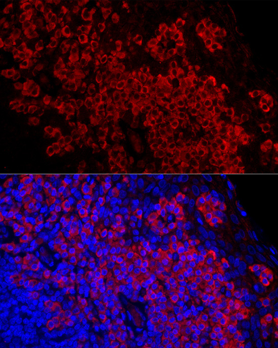 DARC Rabbit Monoclonal Antibody