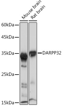 DARPP32 Rabbit Monoclonal Antibody