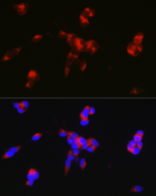 DARPP32 Rabbit Polyclonal Antibody - Image 2