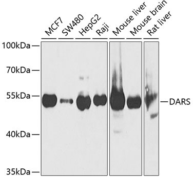 DARS Rabbit Polyclonal Antibody