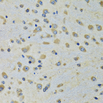 DARS Rabbit Polyclonal Antibody - Image 2