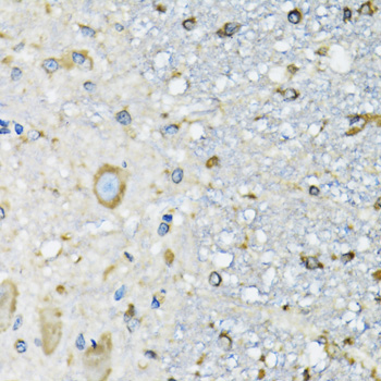 DARS Rabbit Polyclonal Antibody - Image 3