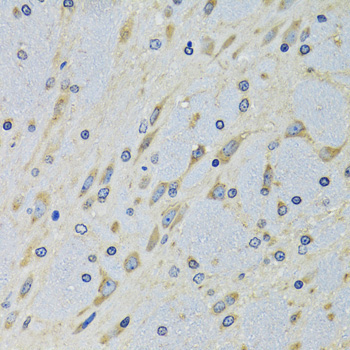 DARS Rabbit Polyclonal Antibody - Image 4