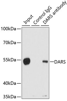 DARS Rabbit Polyclonal Antibody - Image 5