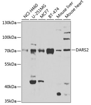 DARS2 Rabbit Polyclonal Antibody - Image 2