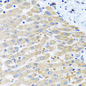 DARS2 Rabbit Polyclonal Antibody - Image 3