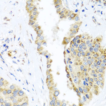 DARS2 Rabbit Polyclonal Antibody - Image 4