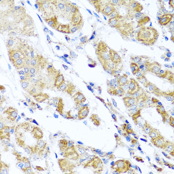 DARS2 Rabbit Polyclonal Antibody - Image 5