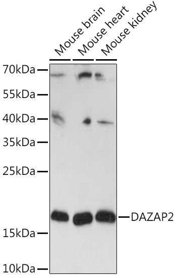 DAZAP2 Rabbit Polyclonal Antibody