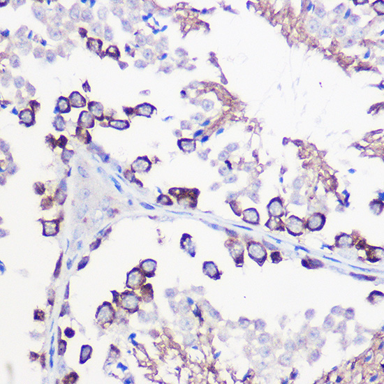 DAZL Rabbit Polyclonal Antibody - Image 3