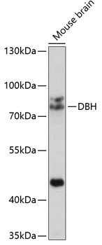 DBH Rabbit Polyclonal Antibody