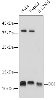 DBI Rabbit Polyclonal Antibody