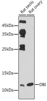 DBI Rabbit Polyclonal Antibody - Image 2