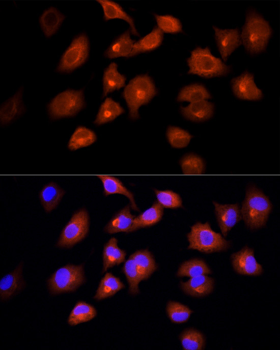DBI Rabbit Polyclonal Antibody - Image 3