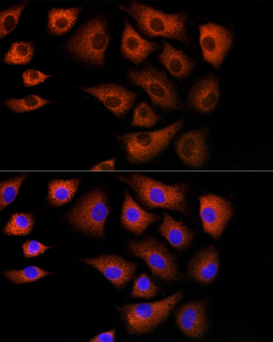 DBI Rabbit Polyclonal Antibody - Image 4