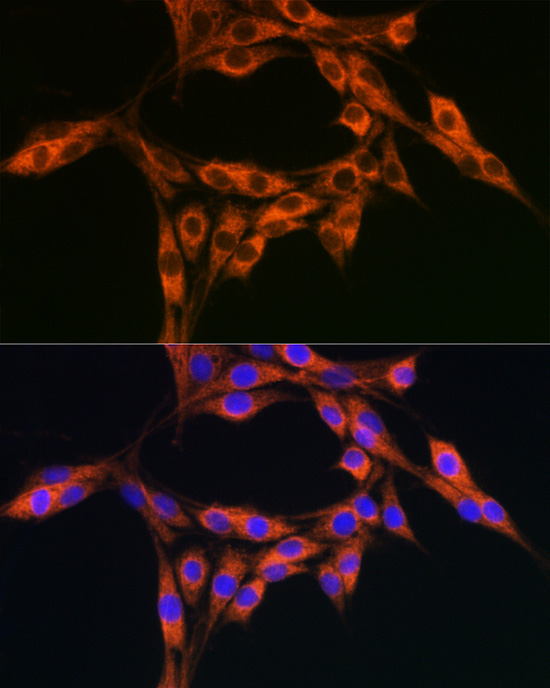 DBI Rabbit Polyclonal Antibody - Image 5