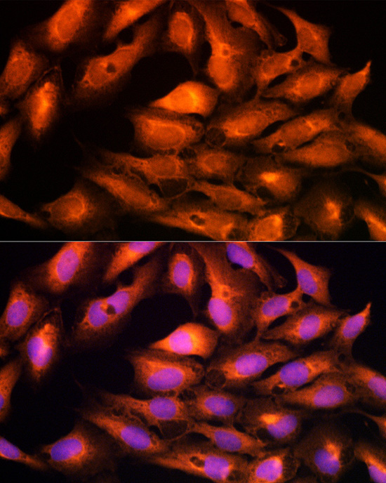 DBI Rabbit Polyclonal Antibody - Image 6