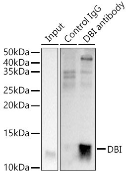 DBI Rabbit Polyclonal Antibody - Image 7