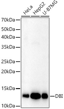 DBI Rabbit Polyclonal Antibody - Image 2