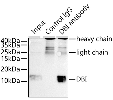 DBI Rabbit Polyclonal Antibody - Image 3