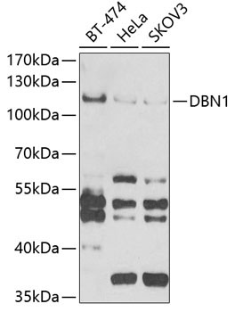 DBN1 Rabbit Polyclonal Antibody
