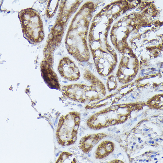 DBT Rabbit Polyclonal Antibody - Image 2