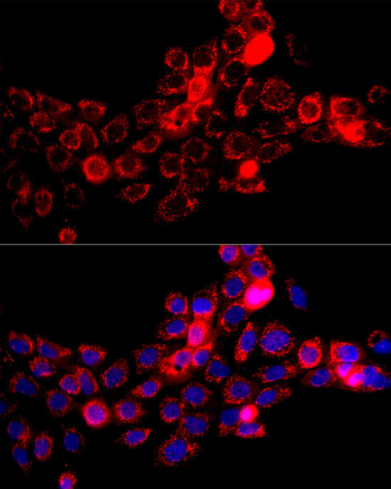 DBT Rabbit Polyclonal Antibody - Image 3