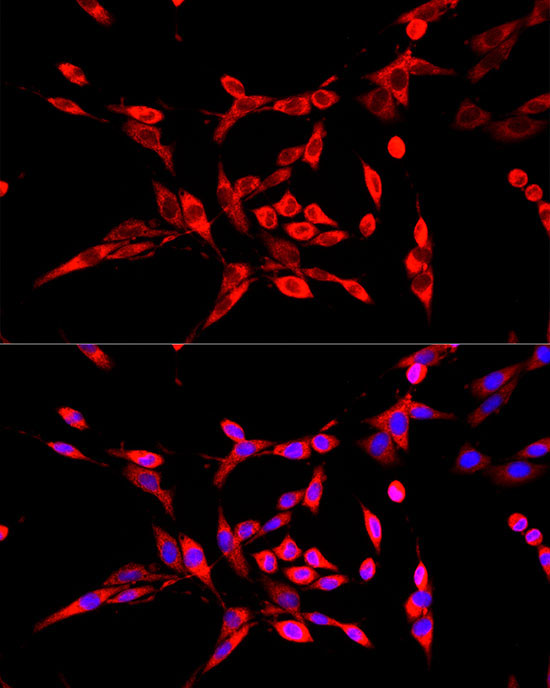DBT Rabbit Polyclonal Antibody - Image 4