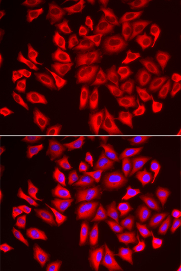 DCAF7 Rabbit Polyclonal Antibody