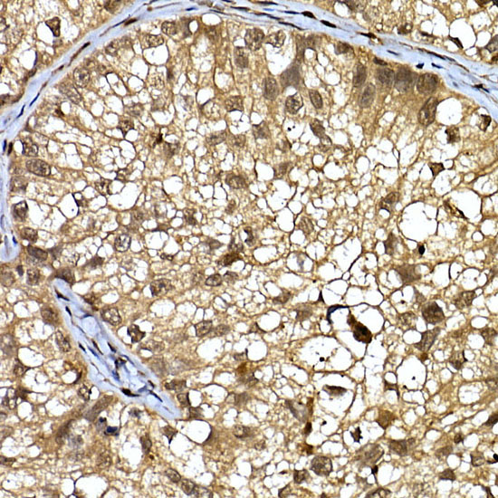 DCAF7 Rabbit Polyclonal Antibody - Image 2