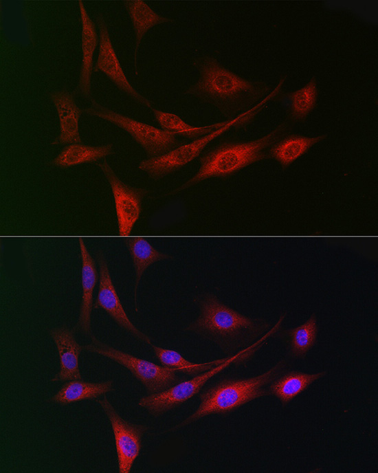 DCAF7 Rabbit Polyclonal Antibody - Image 5