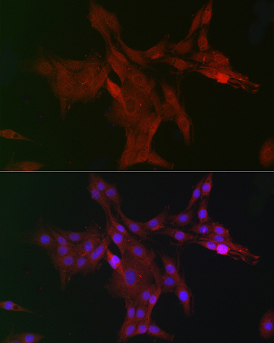 DCAF7 Rabbit Polyclonal Antibody - Image 6
