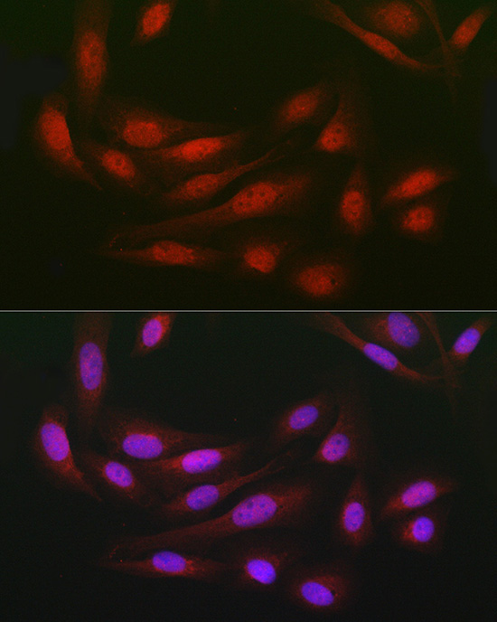 DCAF7 Rabbit Polyclonal Antibody - Image 7