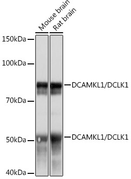 DCAMKL1/DCLK1 Rabbit Monoclonal Antibody