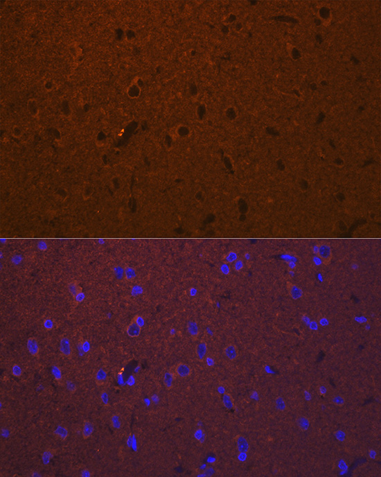 DCAMKL1/DCLK1 Rabbit Polyclonal Antibody - Image 2