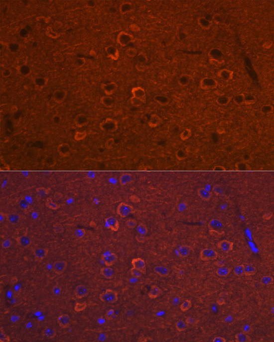 DCAMKL1/DCLK1 Rabbit Polyclonal Antibody - Image 3