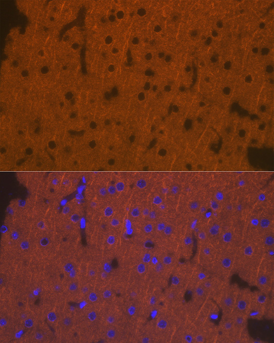 DCAMKL1/DCLK1 Rabbit Polyclonal Antibody - Image 4